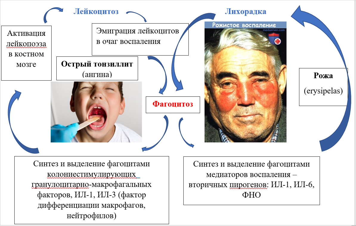 Лейкоцитоз и лихорадка
