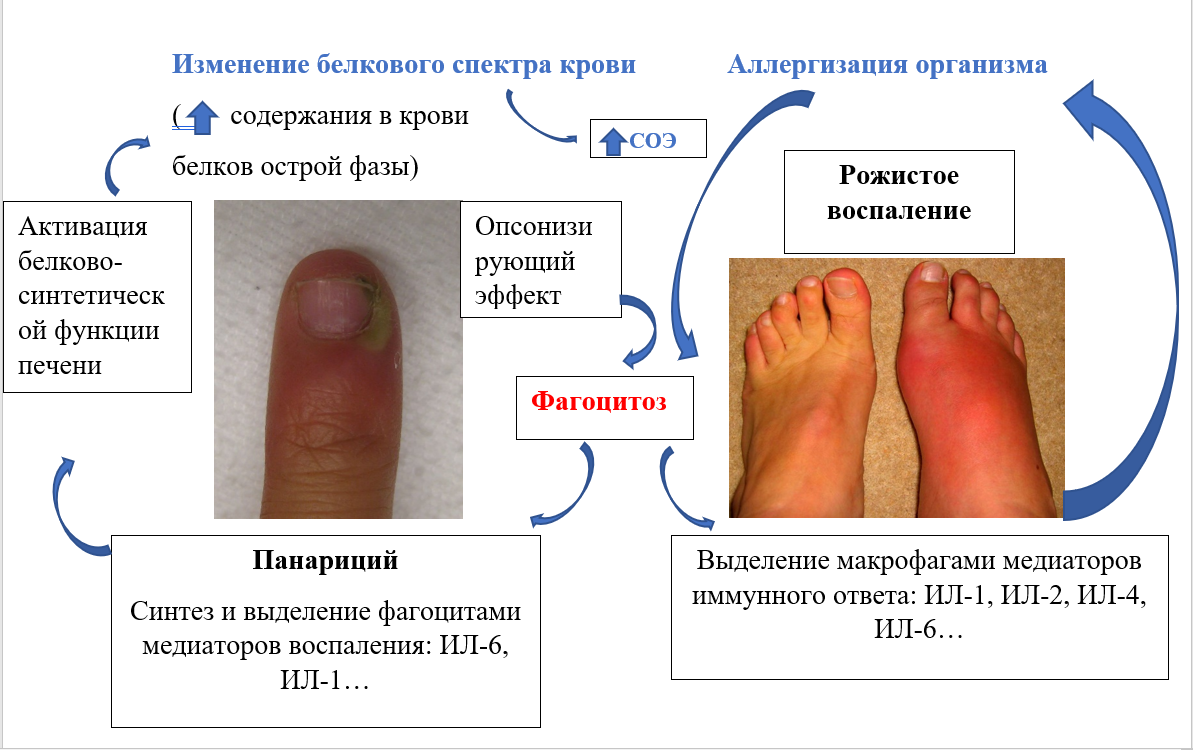 Изменение белкового спектра крови