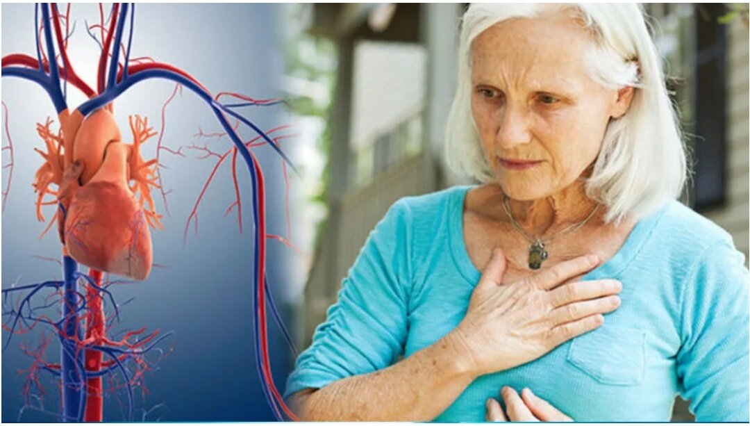 Симптомы инфаркта у пожилых. Сердце у пожилых людей. Заболевание сердца у пожилых людей.