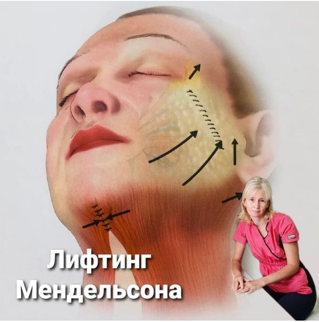 Лифтинг лица по Мендельсону, он же фейс-лифтинг, он же спейс-лифтинг, он же смас-лифтинг (SMAS) ... все это модификации одной операции