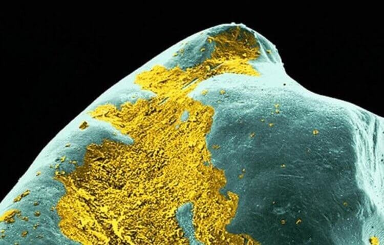 Зубной налёт желтым цветом