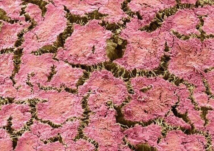 Зубной налёт под микроскопом