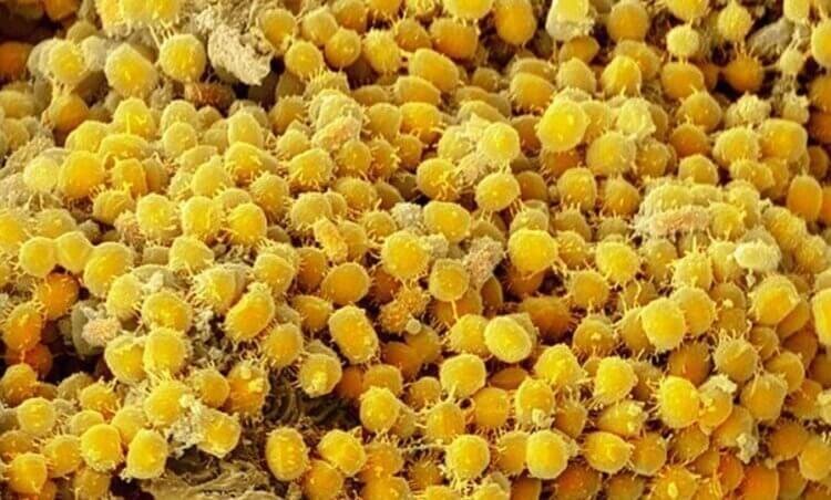 Скопление бактерий на дёснах