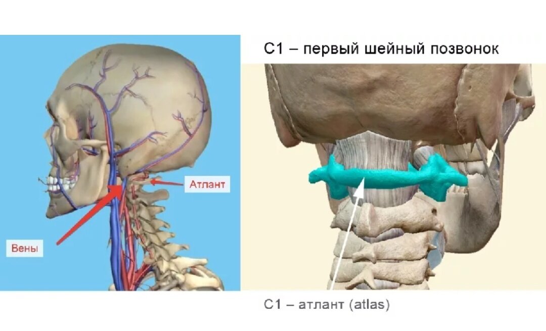 Смещение атланта. Смещение 1 шейного позвонка. Шейный отдел Атлант. Первый позвонок шейного отдела Атлант. Шейный позвонок Атлант вправление.