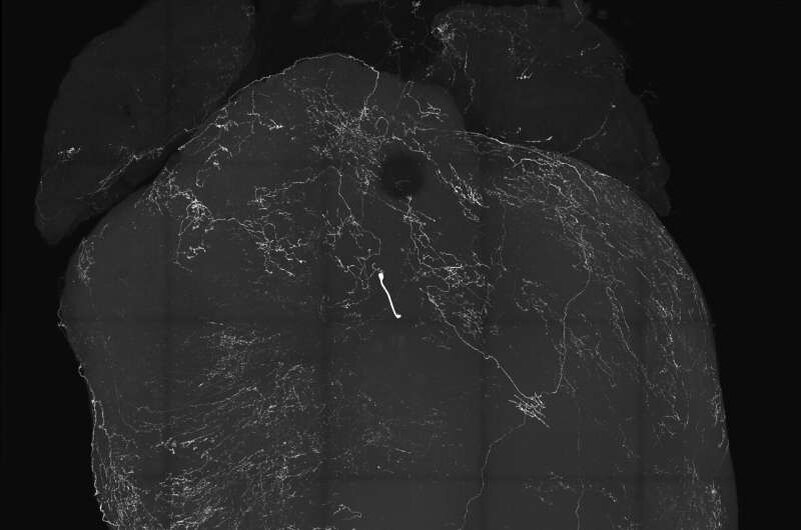 Изображение сердца, размеченное сенсорными нейронами блуждающего нерва. В новом исследовании, опубликованном в журнале Nature , исследователи из Калифорнийского университета в Сан-Диего и их коллеги обнаружили, что эти нейроны вызывают обмороки, закладывая основу для решения проблем, связанных с обмороками. Фото: Augustine Lab, Калифорнийский университет в Сан-Диего.