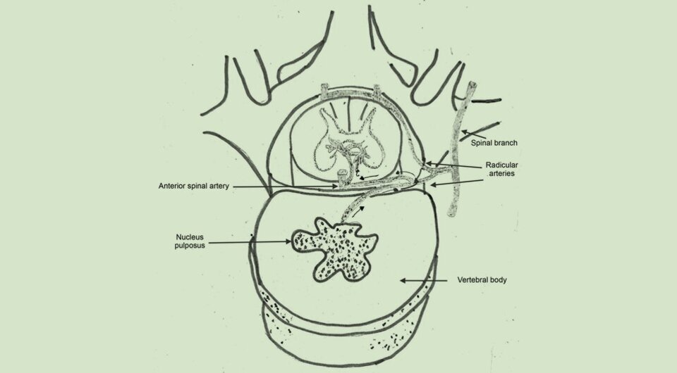   Tharuka Milinda Herath et al. / BMJ Case Reports, 2023