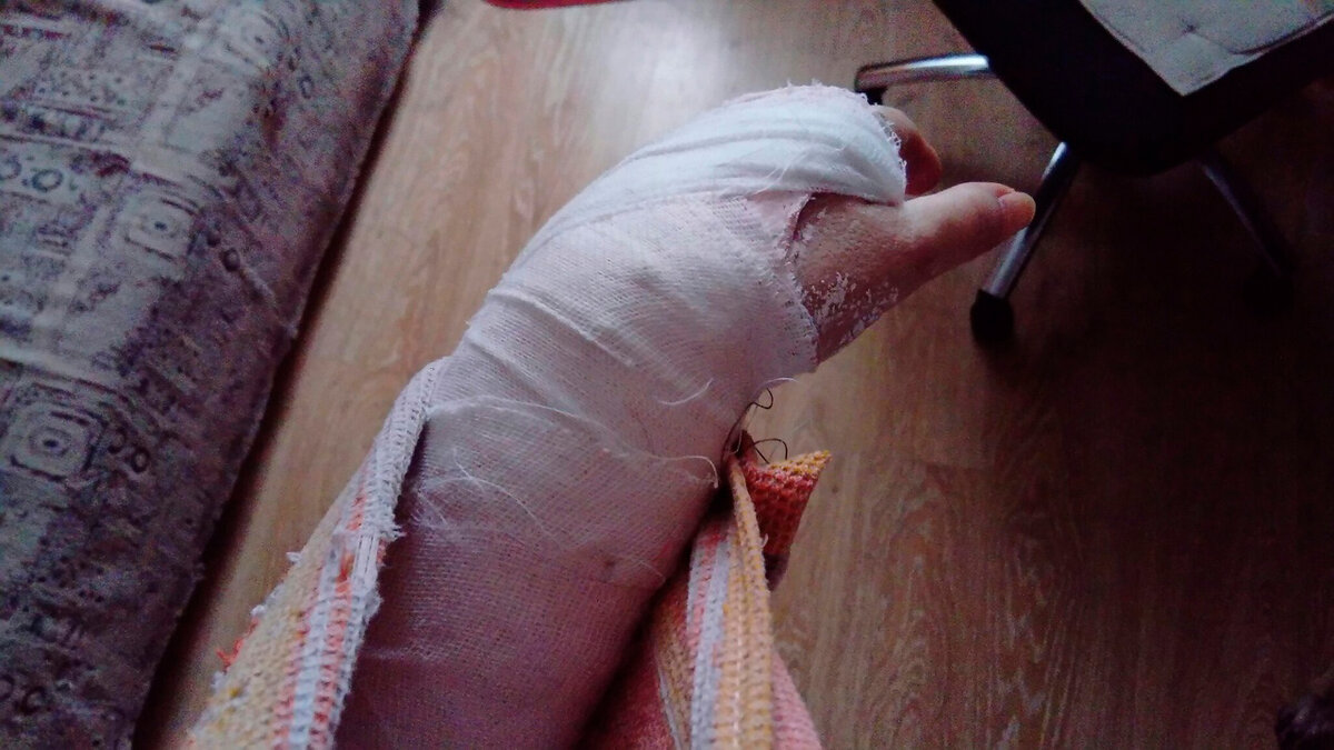 А это я себе смастрячила повязку из старого вафельного полотенца, решила, что удобнее, чем с платком / фото автора