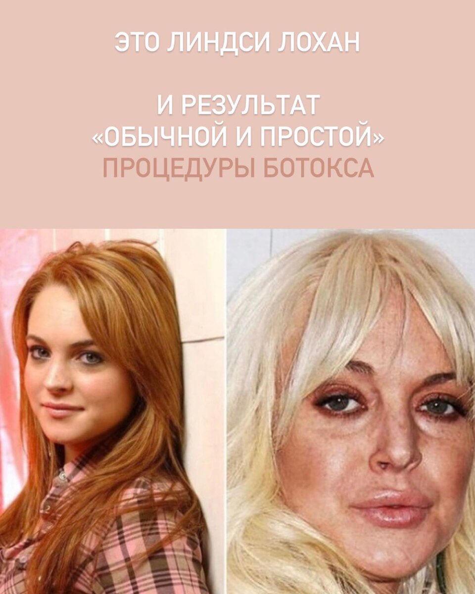 Линдси лохан до и после пластики