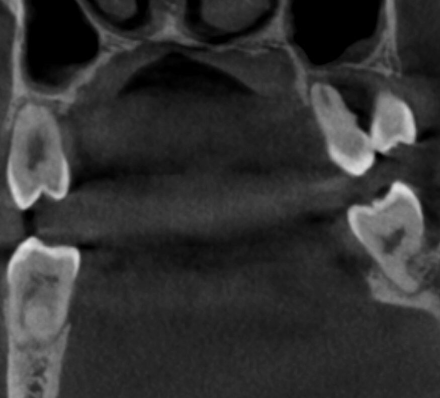 Хотели раздвинуть горизонты, а слетела крыша. Как маскируется "тяжёлый ...