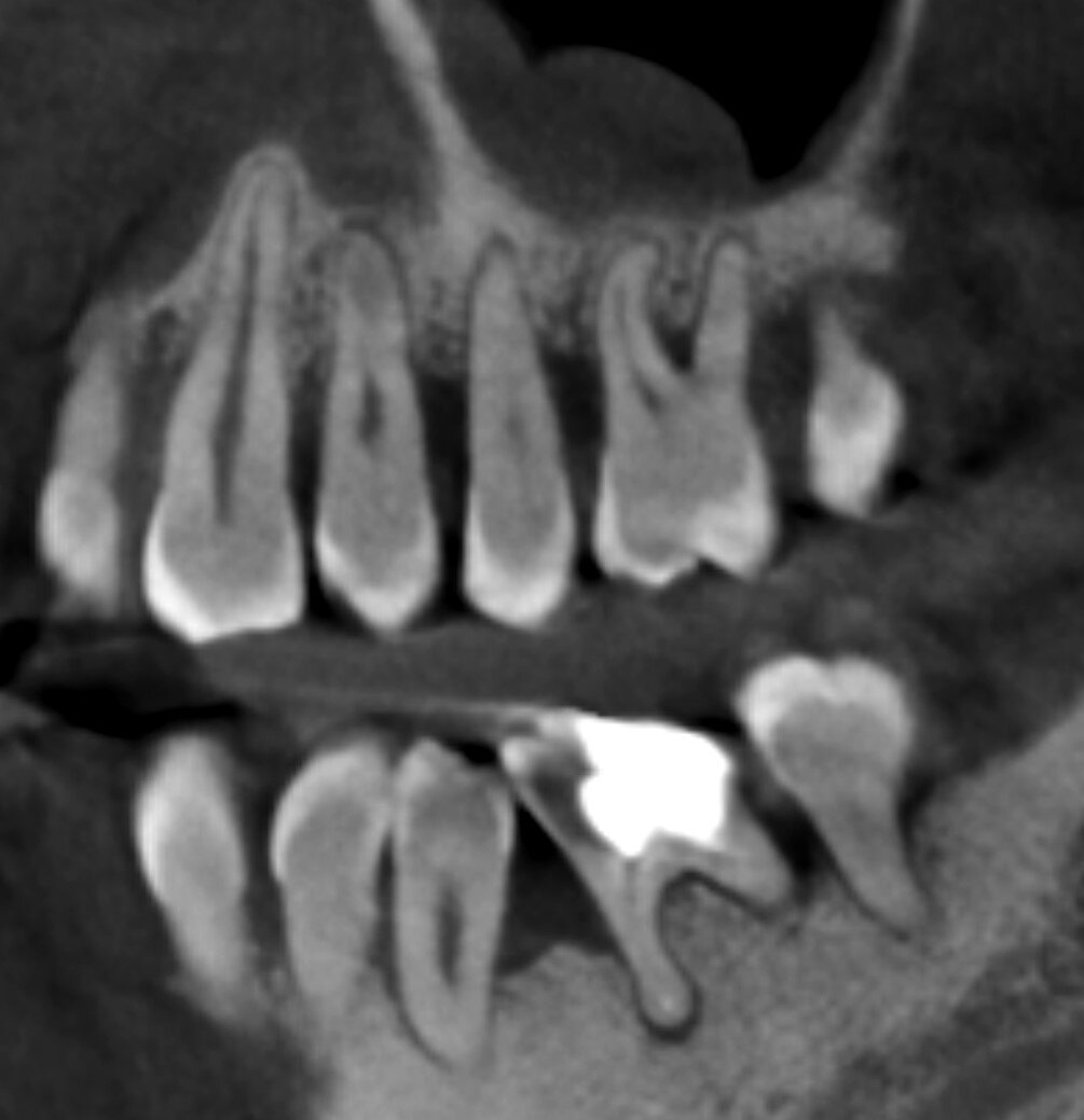 Хотели раздвинуть горизонты, а слетела крыша. Как маскируется "тяжёлый ...