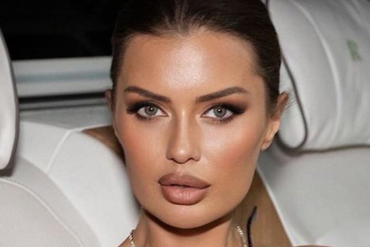     «Голливудский хирург в шоке»: Виктория Боня показала себя до и после пластики