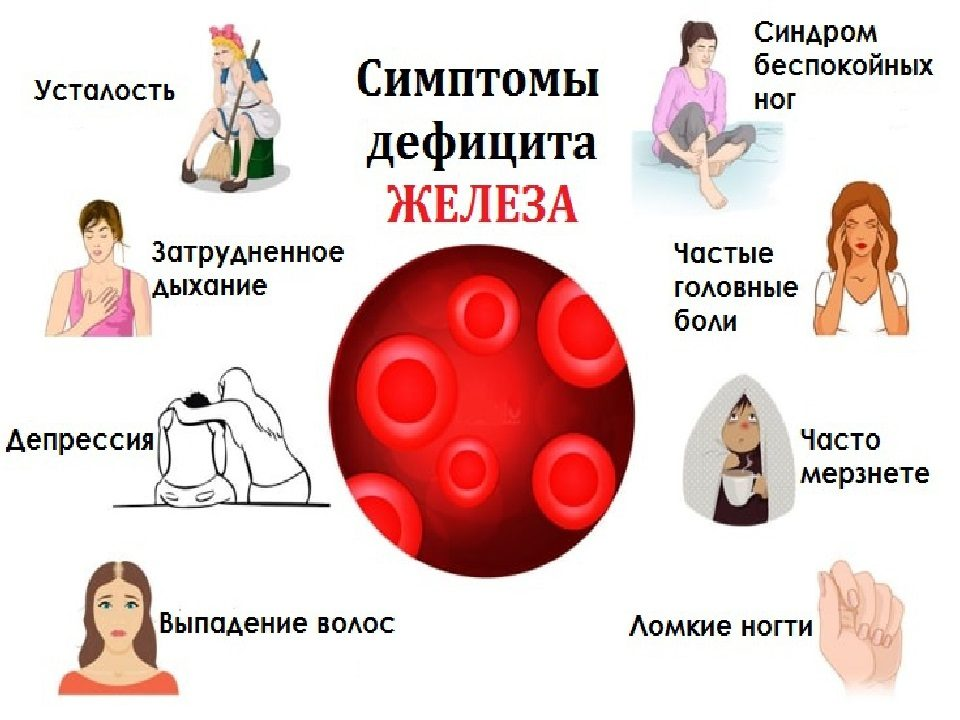 Анемия н. Симптомы дефицита железа анемии. Симтомы Анимия железодефицитная анемия. Анемия симптомы у женщин. Проявления железодефицитной анемии у женщин.