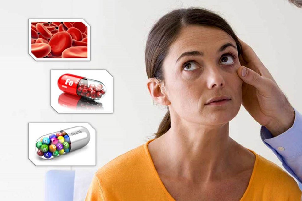 нехватка железа симптомы. признаки дефицита железа.