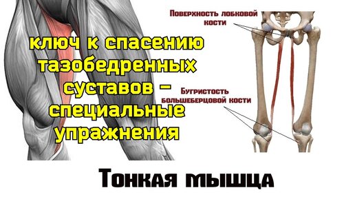 Тазобедренные суставы болят и деградируют с каждым шагом? Восстановите баланс между широкой фасцией и тонкой мышцей бедра