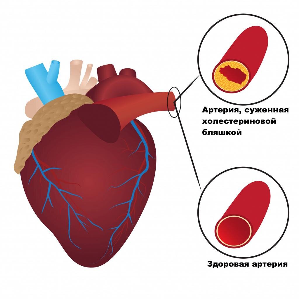 Назван простой способ снизить плохой холестерин без лекарств - Российская газета