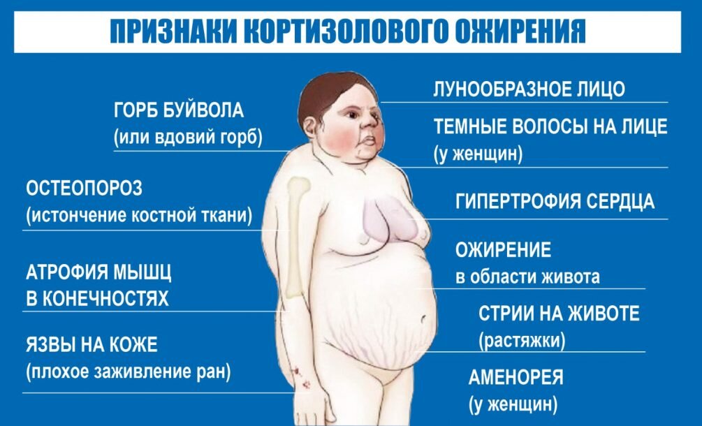 Кортизоловое лицо до и после Синдром иценко кушинга фото