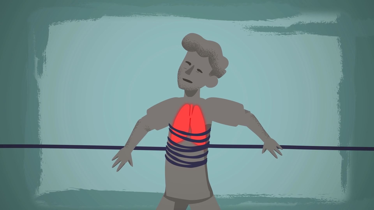 Фактор ограничения