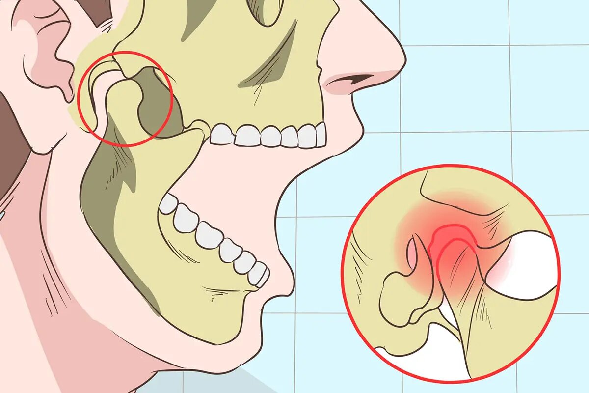 Щелчки или боль при разговоре могут указывать на ВНЧС