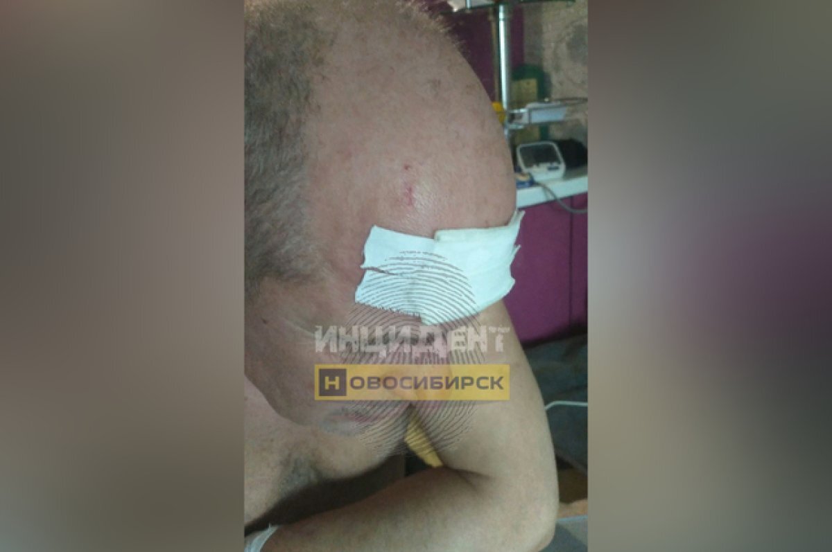    В Новосибирске неизвестные избили и ограбили пассажира такси