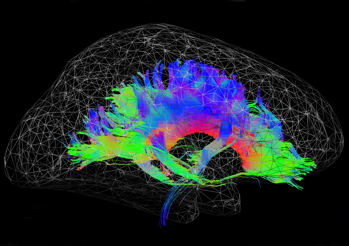 Нейросети fusionbrain. Нейро мозг. Компьютерное моделирование нейронов. Коннектом человека. Нейро связи в головном мозге.