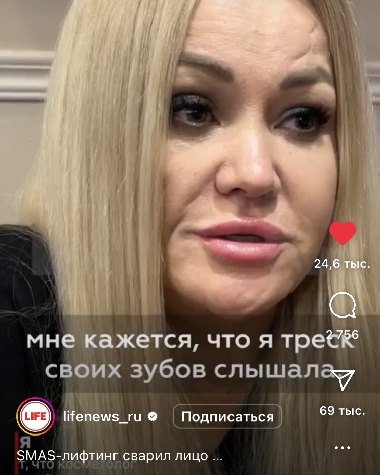 Жертва косметологов