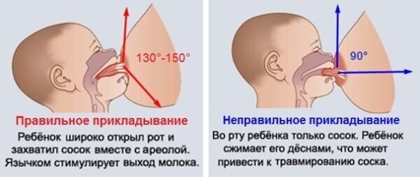 Вот как можно приложить только рожденного ребенка к огромной груди непонятной формы «правильно»?