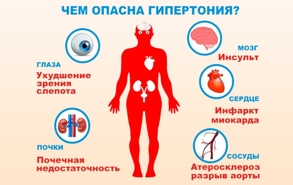 Высокое ад причины. Гипертоническая болезнь. Чем опасна гипертония. Сем опасна гипертония.