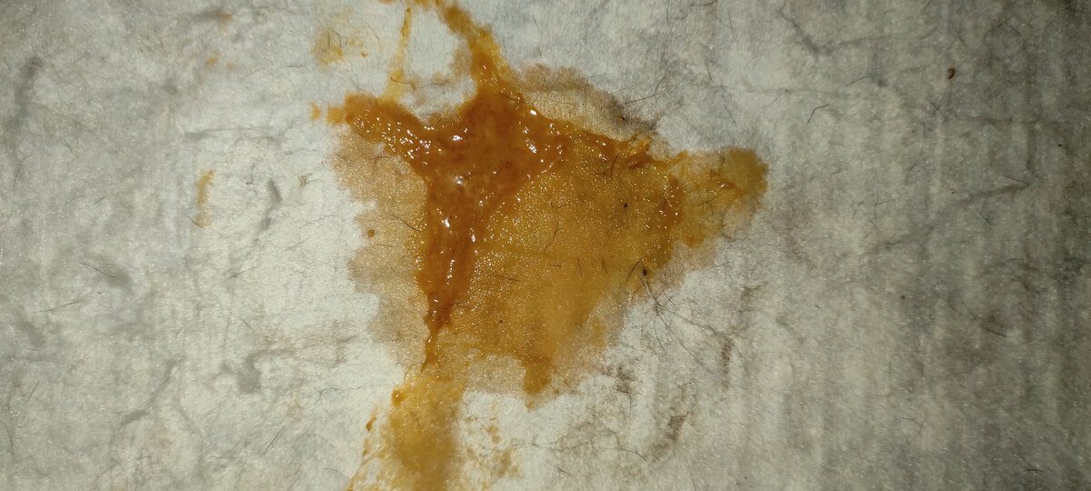 Прошу прощения за такие фото и подробности, но вдруг кому то пригодится данное фото и информация