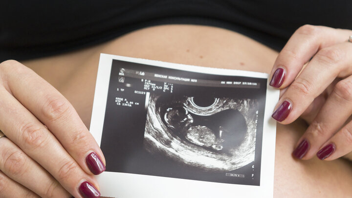 ФОТО: ALEKSEY SMYSHLYAEV/GLOBALLOOKPRESS. 