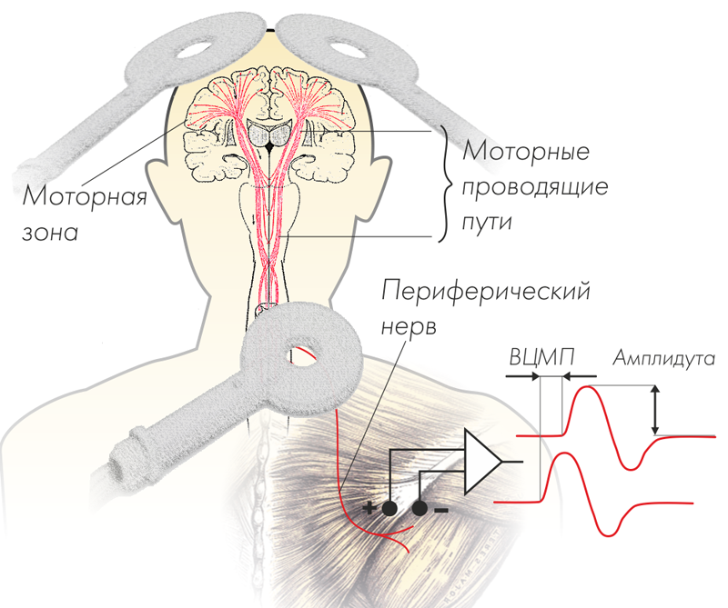 Транскраниальная магнитная. Магнитная стимуляция ТМС. Транскраниальная магнитная стимуляция головного. Транскраниальная магнитная стимуляция (ТМС). Нейро-МС/Д терапевтический расширенный.