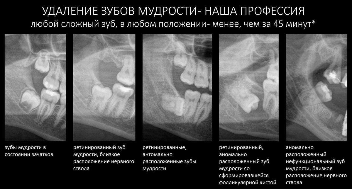 Сестринское дело. Уход за пациентом. Специализированный уход