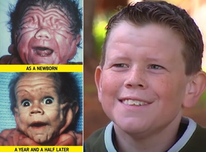  Том при рождении, в год и в подростковом возрасте.