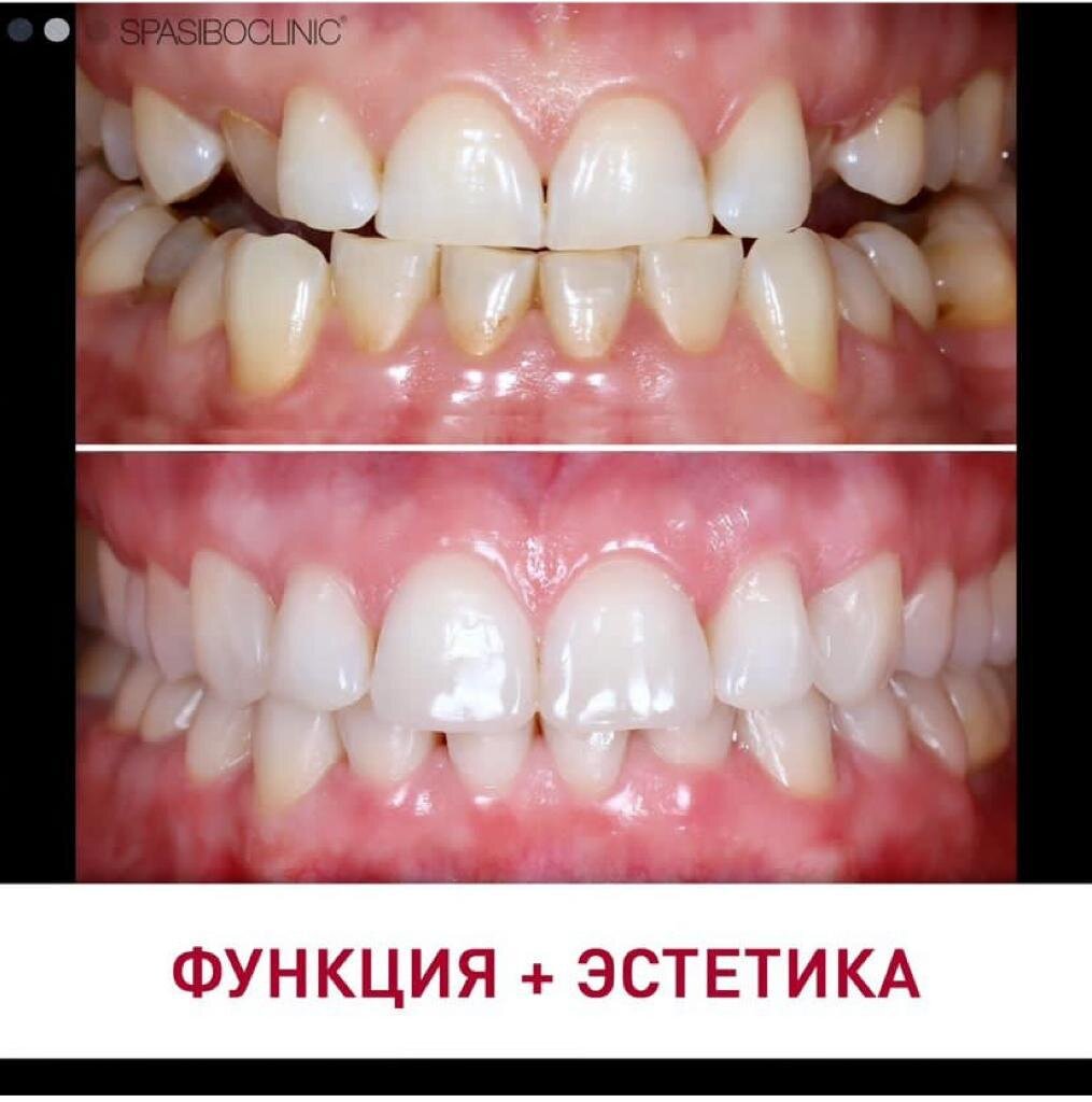 ФУНКЦИЯ + ЭСТЕТИКА | Спасибо.Клиник | Дзен