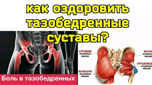 Video herunterladen: Беспокоят тазобедренные суставы? Восстановите их фронтальную стабилизацию, укрепите среднюю ягодичные и приводящие мышцы