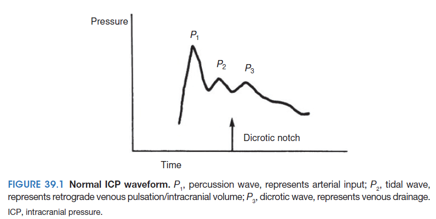 Intracranial pressure