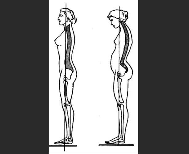 Осанка. Правильная осанка. Биомеханика осанки. Биомеханика в положении стоя.