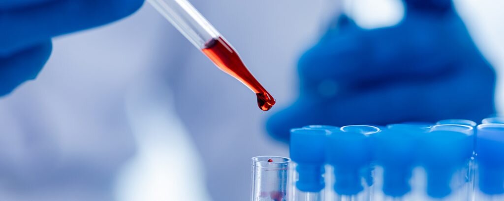    Фото iStock Анна Послянова