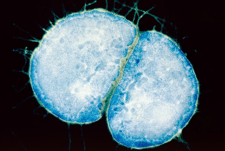 Neisseria gonorrhoeae. Фото: Kwangshin Kim/Science Photo Library