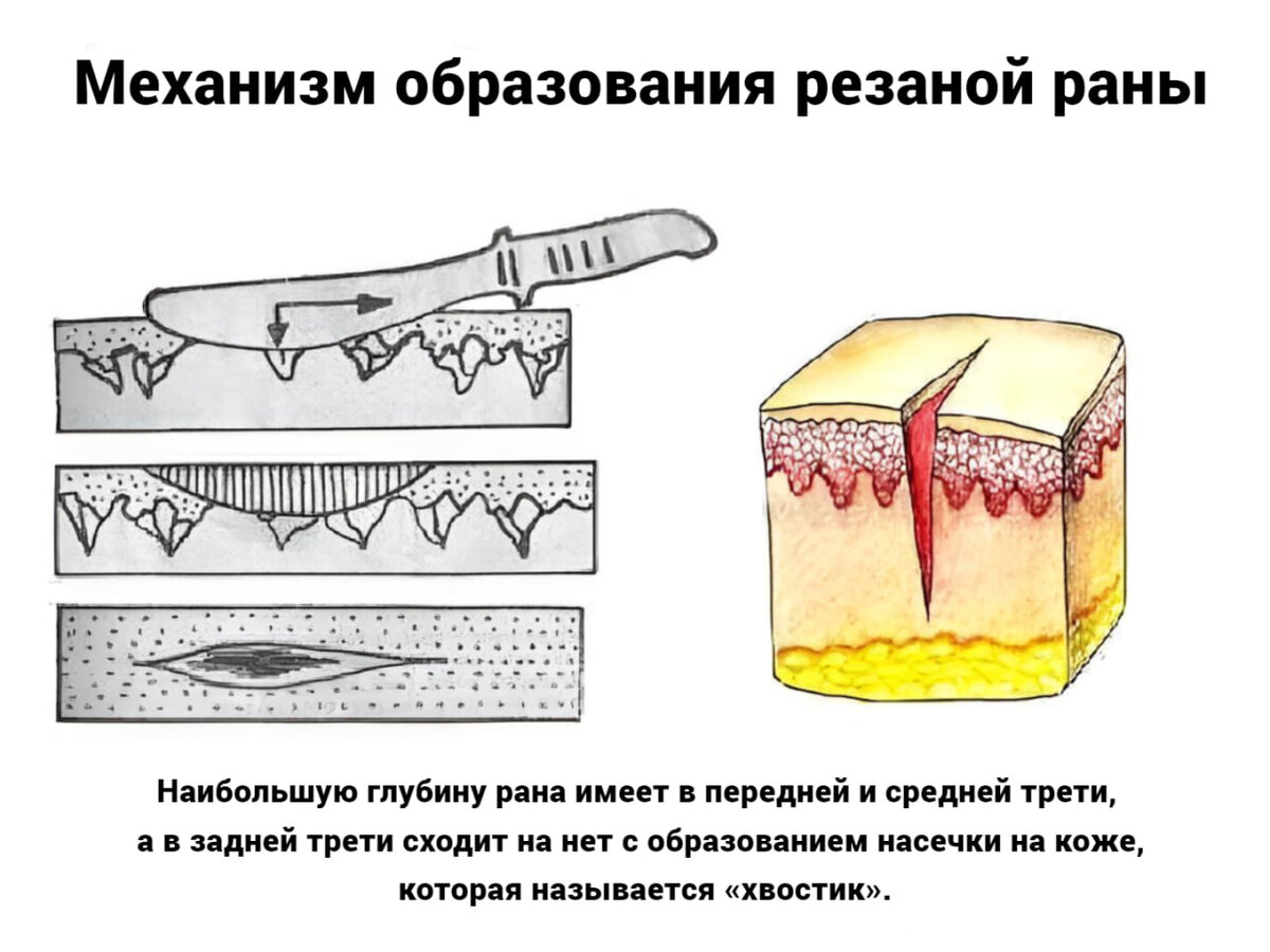 Виды <b>ран</b>! 