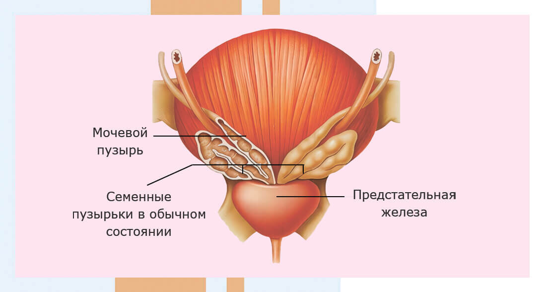 Нормальное состояние