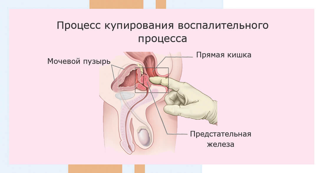 Ретроградная эякуляция: причины, симптомы, диагностика и лечение в Москве | клиника Альтравита