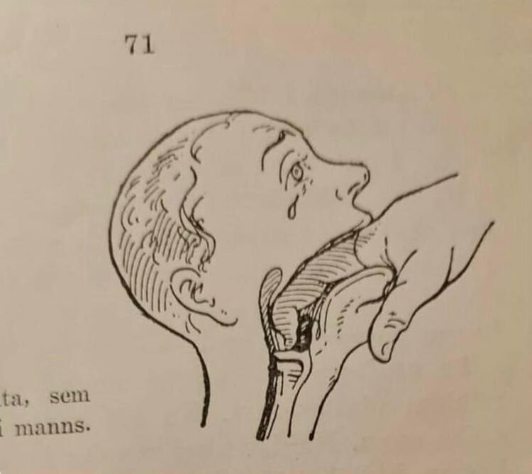 Источник: https://www.reddit.com/r/Weird/comments/17nng6j/how_to_help_someone_who_is_chocking_from_a_1943