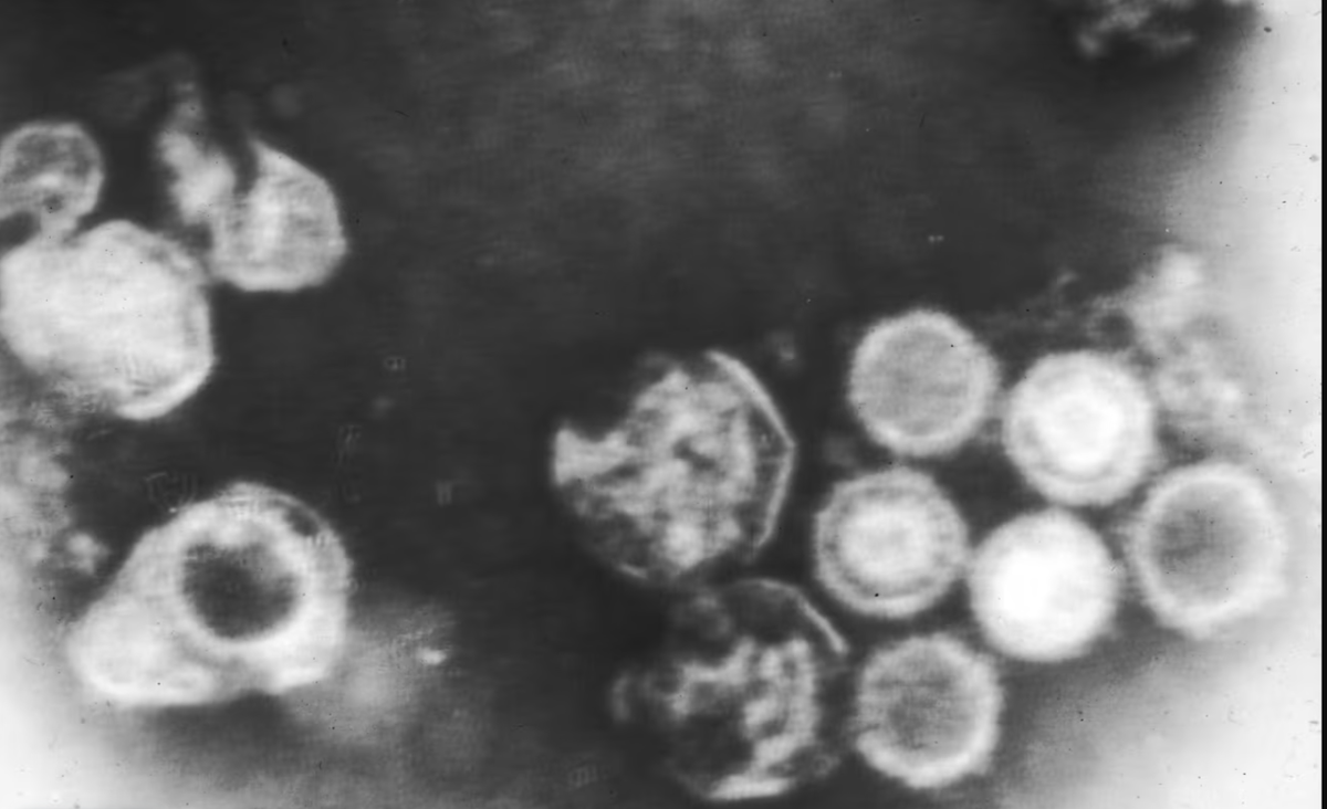 А так выглядит вирус Эпштейна-Барр на экране электронного микроскопа. Не так красиво, не правда ли? Фото из открытых источников