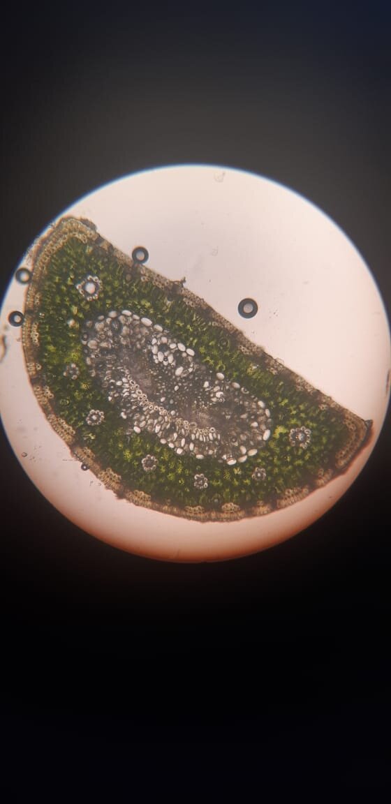 Пробный срез хвоинки группой 9 класса 2022 года (чёрные кружочки воздуха не должны быть, но они есть) 