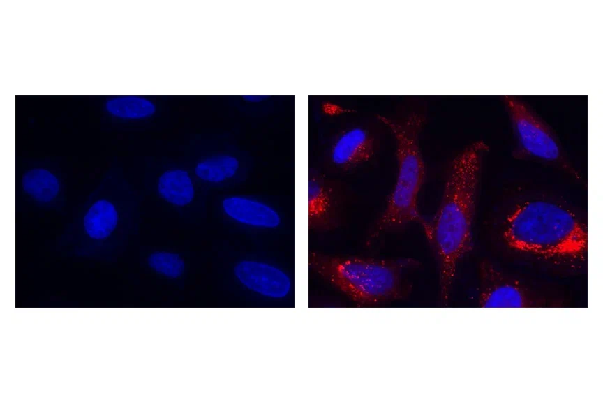 На слайде проиллюстрировано флуоресцентное изображение здоровых клеток и окисленных клеток, на которые воздействует АФК (гидроксильный радикал). Источник: Reactive Oxygen Species (ROS) Detection [4].