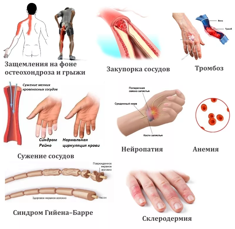 Почему немеют кисти рук. Немеют руки. Болит сустав кисти левой руки. Немеют и болят кисти рук.