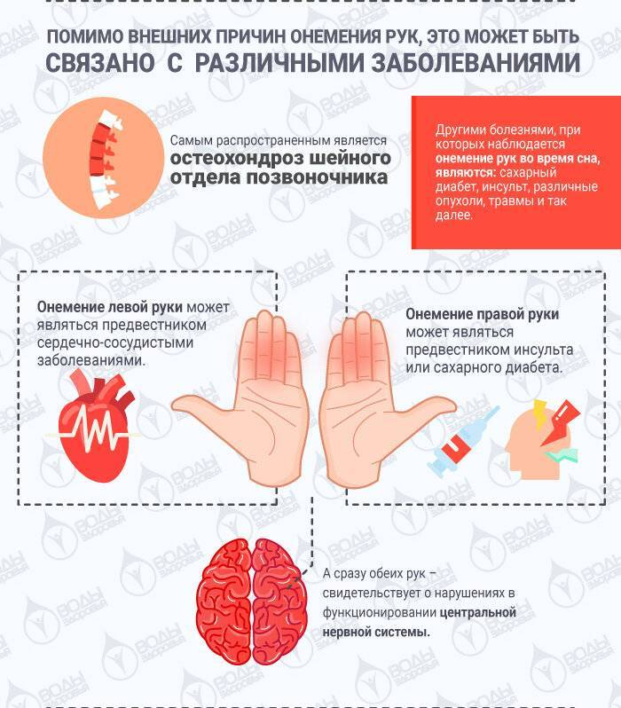 Немеют руки причина. Онемение пальцев рук причины. Руки затекают и немеют.