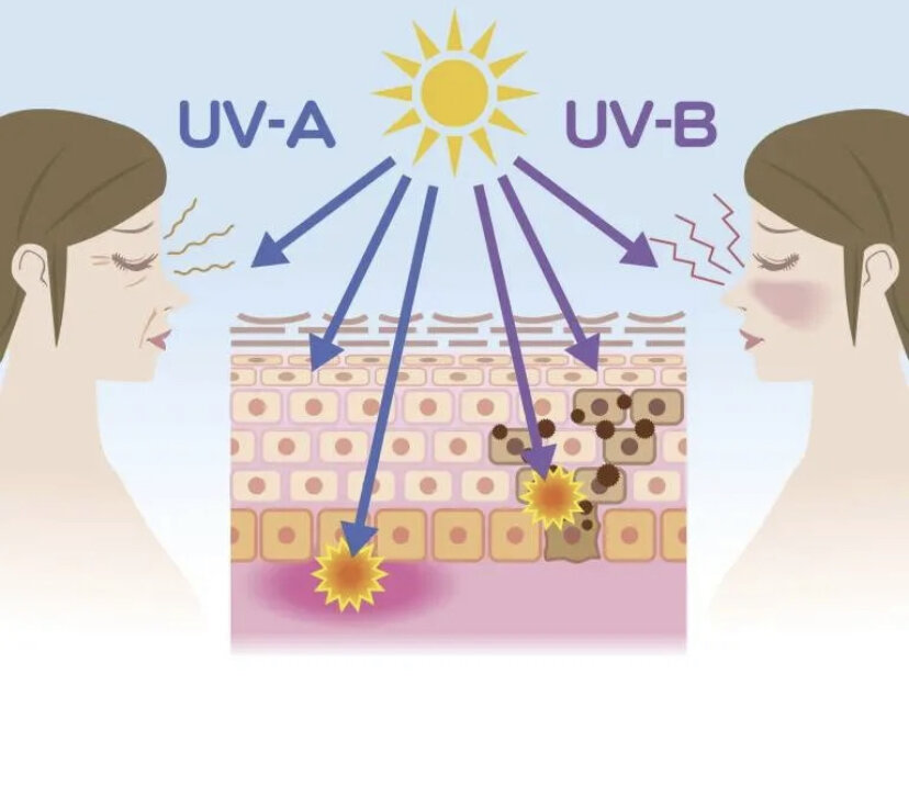 Как действует солнечное излучение