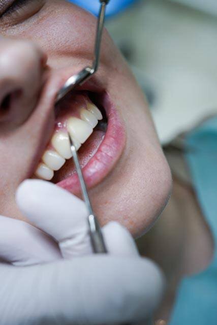 Лечение зубов во время беременности 