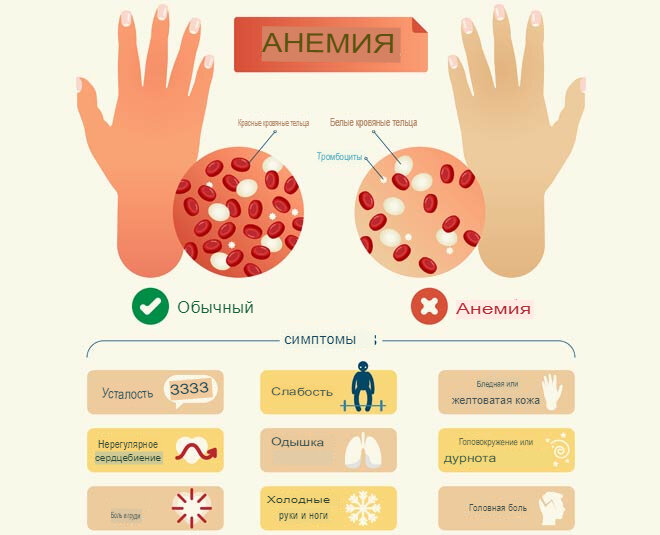 Thrombocytosis латынь